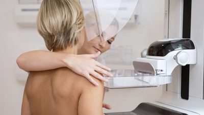 Básico de mamografía