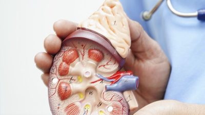 Enfermería nefrológica