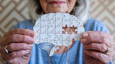 Alteraciones degenerativas, demencias y Alzheimer