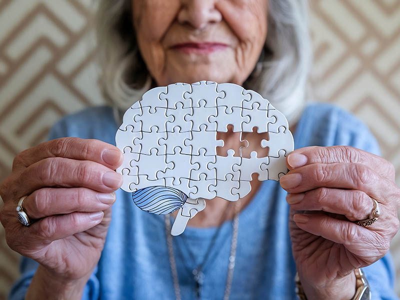 Alteraciones degenerativas, demencias y Alzheimer